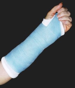 broken arm